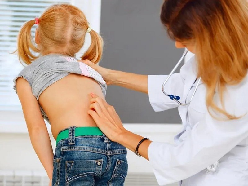 کدام کودکان در معرض ابتلا به انحراف ستون فقرات هستند؟
