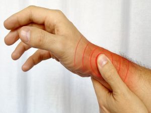 ورزش برای آرتروز مچ دست
