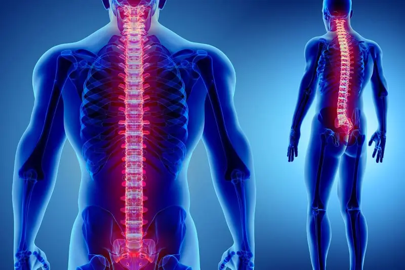 دلایل ایجاد آرتروز ستون فقرات